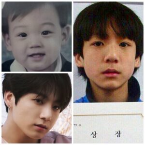Bts Plastic Surgery Before And After - Bts Army!